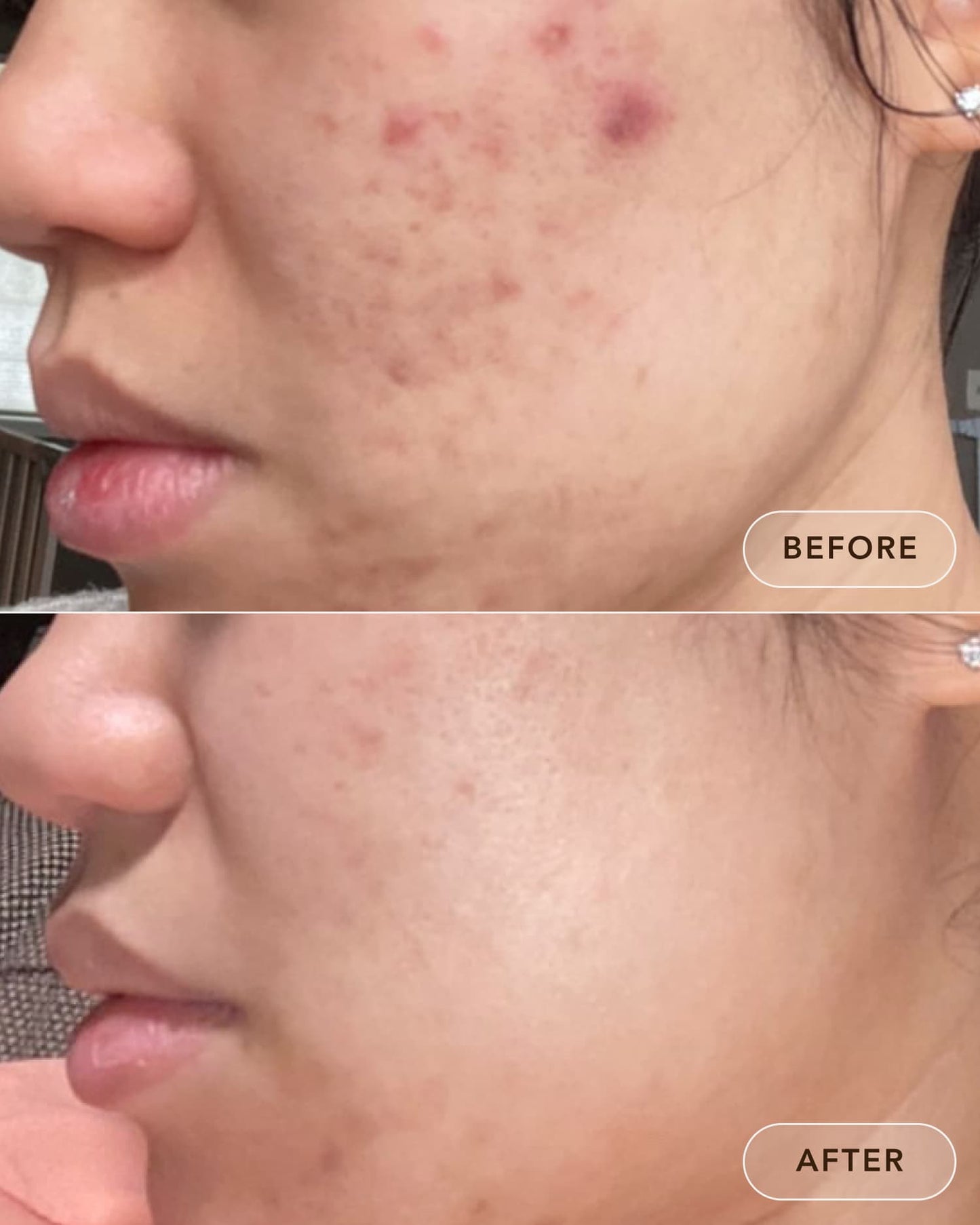 before and after results using dezi skin claro que c vitamin c glow serum showing reduced dark spots and clearer skin
